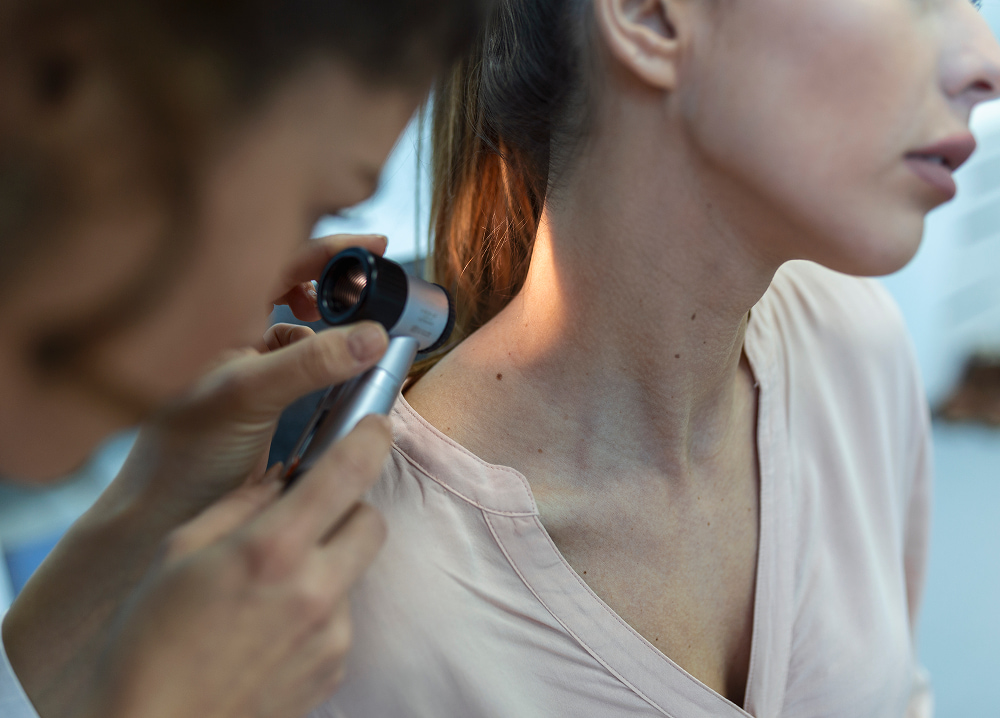 Professional mole and skin lesion check at Yoland dermatology clinic Nadd Al Hamar Dubai