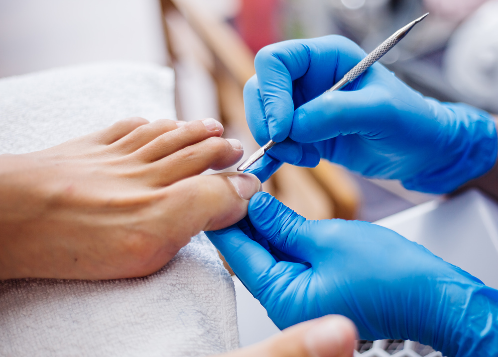 Nail fungus and nail disorder treatment at Yoland clinic Dubai