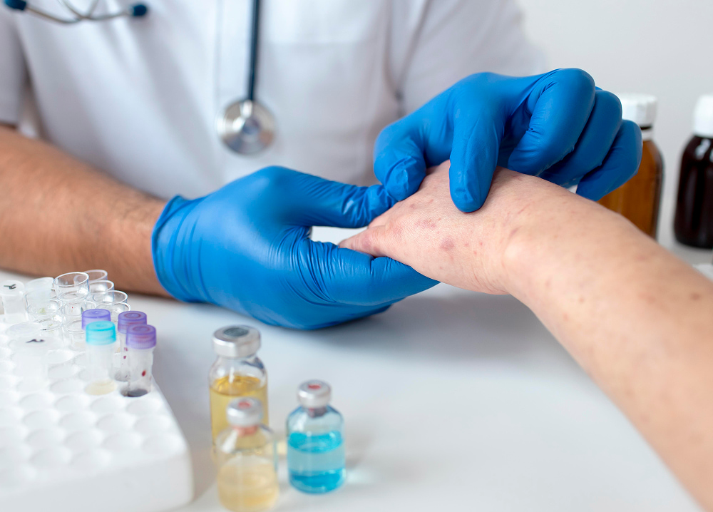 Psoriasis treatment and management at Yoland dermatology clinic Dubai